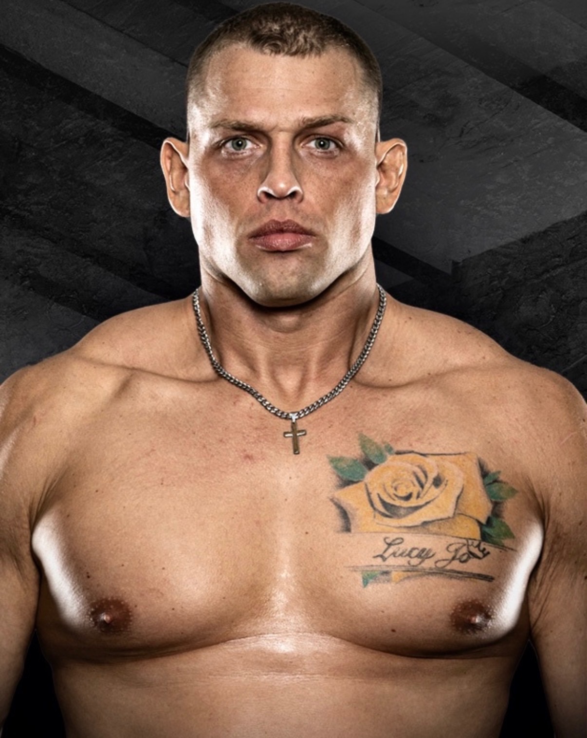 Anthony Garrett